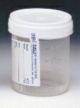 Specimen Container for Pneumatic Tube Systems Vollrath 90 mL (3 oz.) Screw Cap Sterile Inside Only