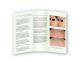 Cutera LimeLight IPL Facial Skin Rejuvenation Pigmentation Vein Brochures 25/pck