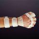 Anti-Spasticity Ball Splint Rolyan® Preformed Thermoplastic Right Hand Beige Medium